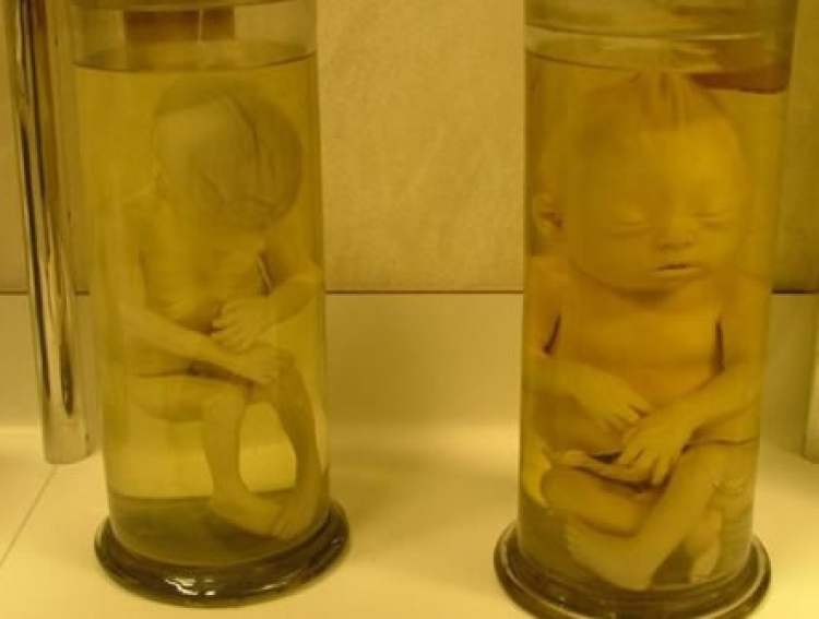 Tmerr! Zbulohen dy foshnja pa jetë…ishin ruajtur në shishe