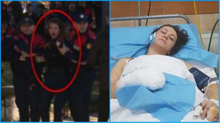 Humbi gishtat në protestë, ja si është gjendja e polices Ina Nuka pas 7 orëve operacion! [FOTO]