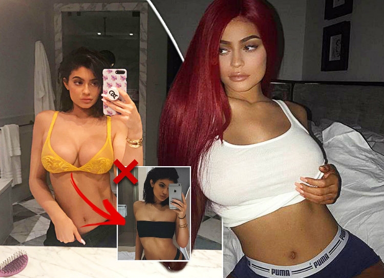 Ups! Kylie të kapëm MAT! Këto FOTO nga Met Gala tregojnë hapur ndërhyrjet në gjoks [FOTO]