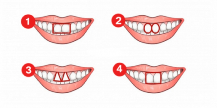 Forma e dhëmbëve tregon shumë për personalitetin tuaj