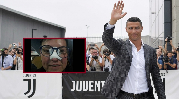 Ajo kërkoi një darkë me të pasi i theu hundën, ja VERPIMI i Ronaldo-s për tifozen ''bardhezi'' që po bën ‘’xhiron’’ e rrjetit