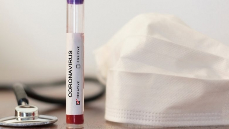Ministria e Shëndetësisë: 59 numri i të prekurve nga koronavirusi. 4 raste të reja sot
