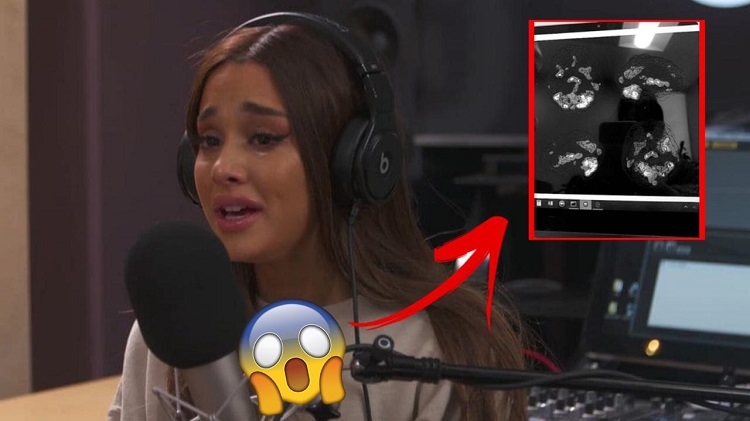 'Nuk është shaka!' Ariana Grande jep lajmin në lidhje me sëmundjen e keqe [FOTO]