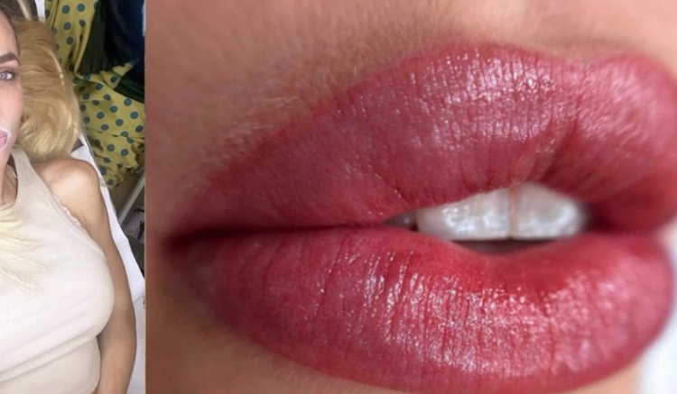 FOTO/Moderatorja e njohur bën tatuazh te buzët, tregon rezultatin LIVE