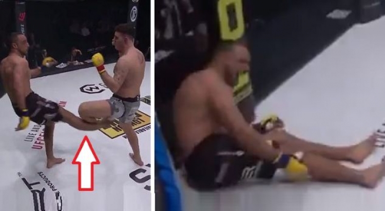 Ndeshja për titull në MMA/ Godet kundërshtatin, por këmba e tij pëson dëmtimin e tmerrshëm [VIDEO]