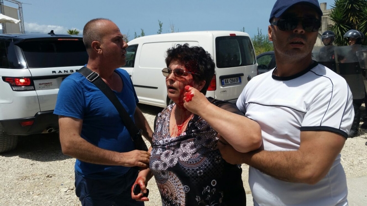 Tension në Vlorë, Lungomare “përgjak” qytetarët [FOTO]
