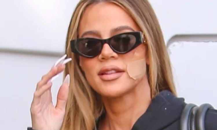 Khloe Kardashian heq një tumor të rrallë nga fytyra