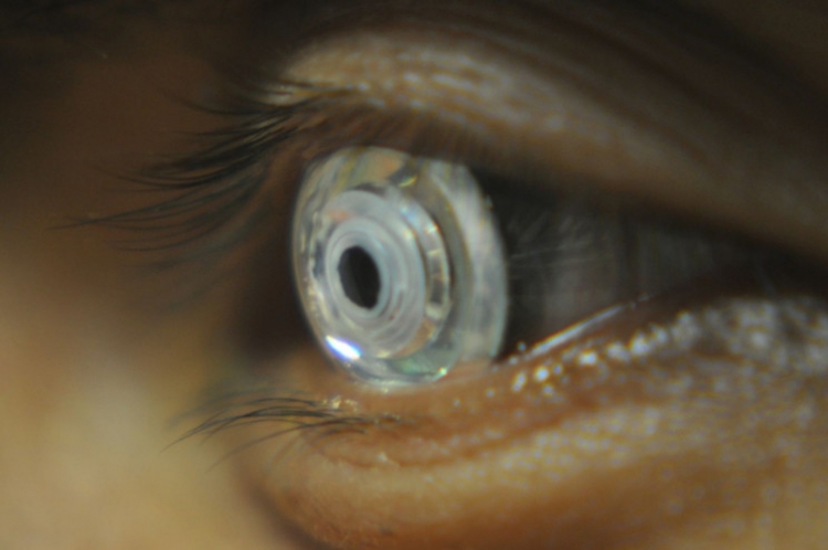 Krijohen lentet që zmadhojnë pamjen me komandën e syve tuaj. Ja si funksionojnë