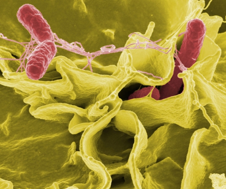 Belgjikë, 118 nxënës infektohen me bakterin e Salmonellës
