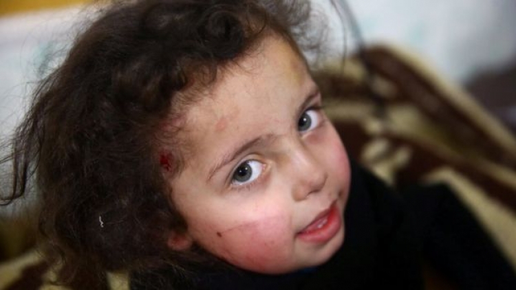 Lufta e Sirisë: Këshilli i Sigurimit i OKB-së miraton armëpushimin 30-ditor [FOTO]