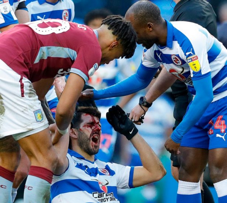 E tmerrshme/ E shkelin me këmbë në fytyrë, ja gjendja e futbollistit! [FOTO]