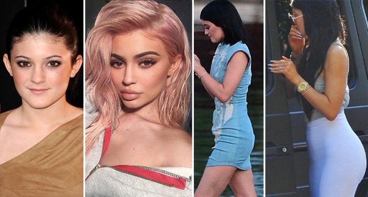 'Nga buzët deri tek të pasmet', ja sa miliona ka shpenzuar Kylie Jenner për tu transformuar [FOTO]