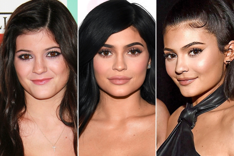 Ç'nuk i thonë për ndërhyrjet, Kylie Jenner e thotë TROÇ: “Kam bërë buzët pasi u putha me një djalë, më tha …”