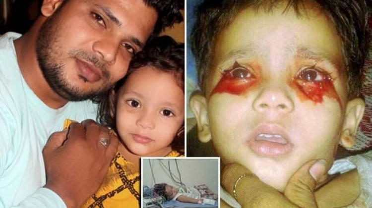 Tronditen mjekët, 3-vjeçarja nxjerr gjak nga sytë në vend të lotëve