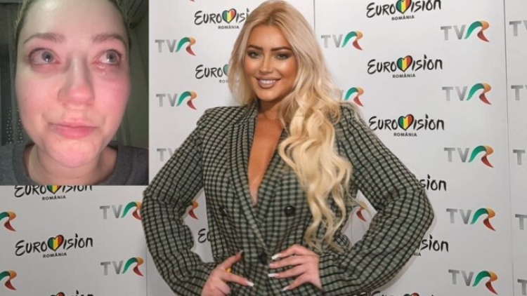 E përlotur, Ronela Hajati ‘hap zemrën’ me fansat para Eurovizionit: “Jam në një periudhë shumë delikate të jetës sime”