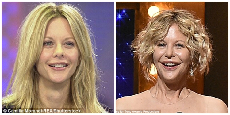 Meg Ryan sqaron për herë të fundit rreth ndërhyrjeve estetike [FOTO]