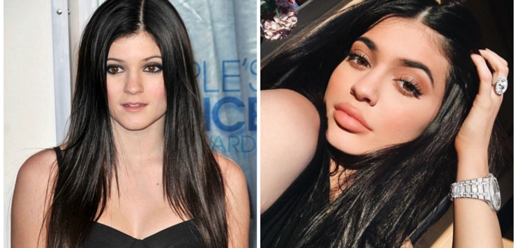 Zbuloni hap pas hapi metamorfozën e pamjes së Kylie Jenner [FOTO]