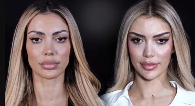 I nxorrën fotot e ndërhyrjeve estetike kur ishte në Big Brother, Brikena bën reagimin e papritur: Tradhti, janë publikuar shumë