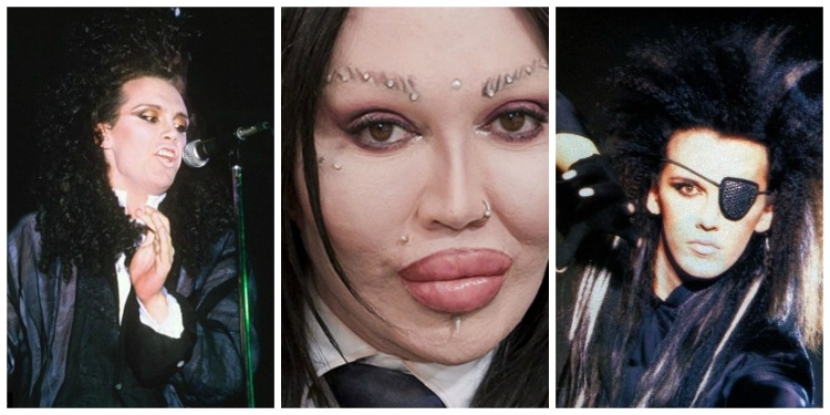 Tronditëse: Humb jetën artisti Pete Burns, shkak 300 operacionet plastike! [FOTO]