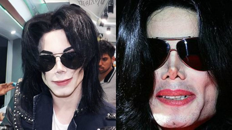 Kërkon të mbajë gjallë kujtimin e tij, adoleshenti bën 11 operacione plastike për t’u dukur si Michael Jackson