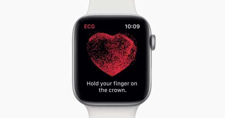Apple Watch sjell opsionin e fundit. Paralajmëron problemet e zemrës