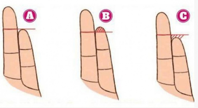 Ja çfarë tregon për ju gjatësia e gishtit të vogël! E dinit?
