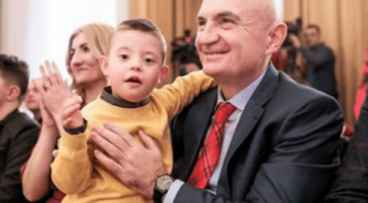 Dita Botërore e Sindromës Down merr vëmendjen e Presidentit: Kujdesuni për këta fëmijë