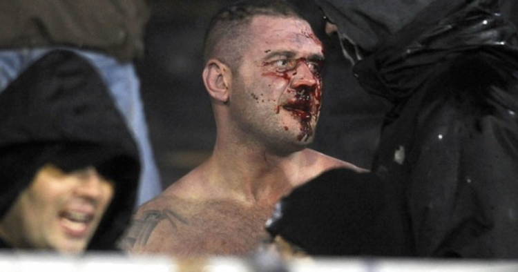 Gjendje lufte në derbin Partizan – Zvezda: 17 të lënduar, një në gjendje të rënd [FOTO/VIDEO]