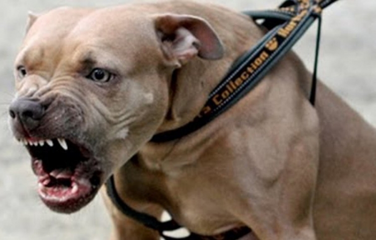 Ngjarje e rëndë në Elbasan, e kafshoi qeni 