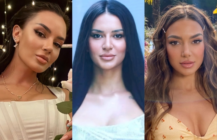 Tërhoqi vëmendjen për ngjashmërinë me Bora Zemanin, por shihni si dukej Efi e Përputhen para ndërhyrjeve!