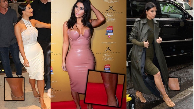 Duket kaq perfekte me make-up, por Kim Kardashian sapo na rrrëfeu sekretin e ‘’errët’’: ‘’Kam një sëmundje, që duket si mut…’’