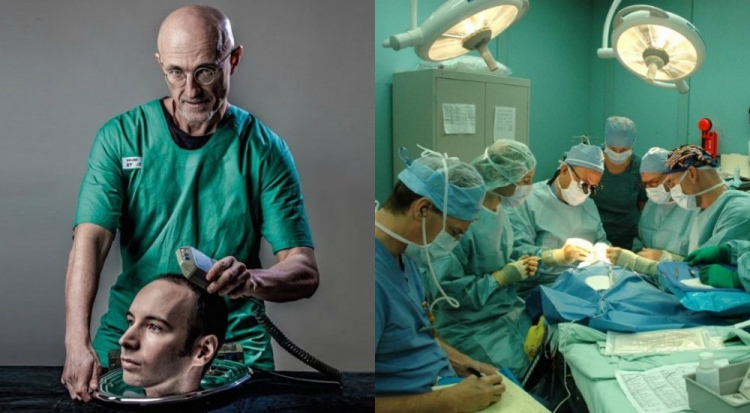 Në dhjetor do bëhet transplantimi i parë i kokës, vullnetar një 30 vjeçar [FOTO/VIDEO]