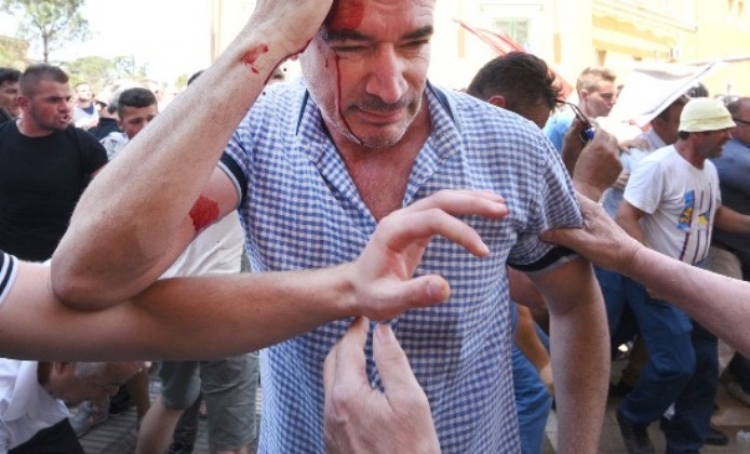 Gjendja e të plagosurve në protestë. Flet drejtori i Spitalit Ushtarak [Foto]
