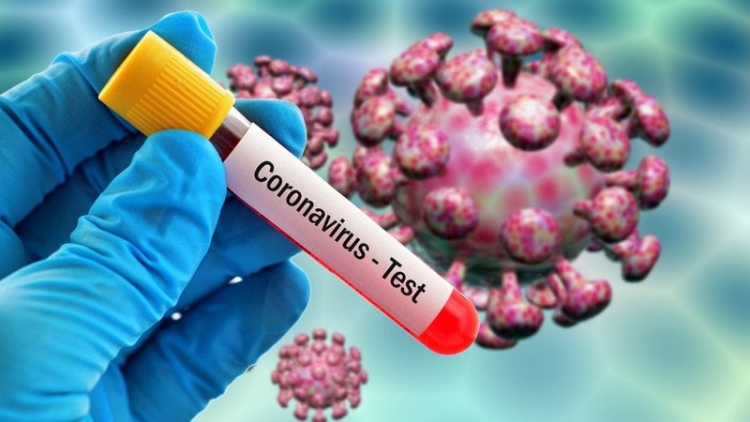 31 raste të reja me koronavirus në Shqipëri, rritet numri i viktimave